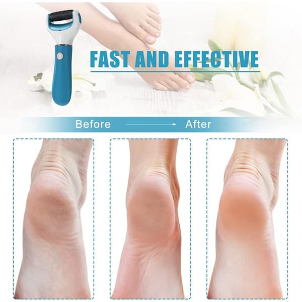 Electric Foot File for Dead Skin Removal with 2 Roller Heads, Rechargeable Battery, Blue, Compatible with Pedicure Tools