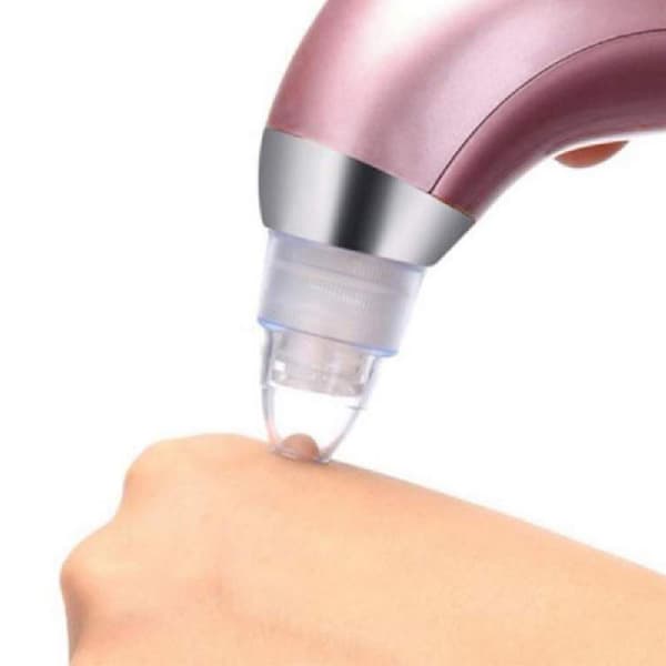 SKIN XN-8030 Hudormevakuum - effektiv genopladelig hudormefjerner
