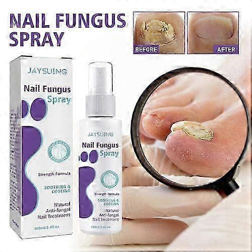 1-pack daglig nagelvårdsspray