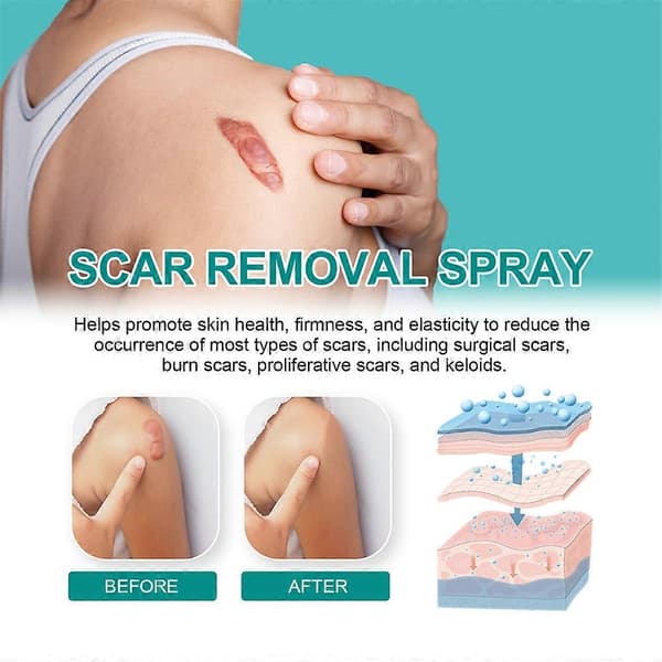 Scar Remove Advanced Spray til alle typer ar, især acne-ar, kirurgiske ar og strækmærker 20g (2 stk.)