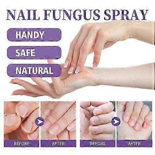 1-pack daglig nagelvårdsspray