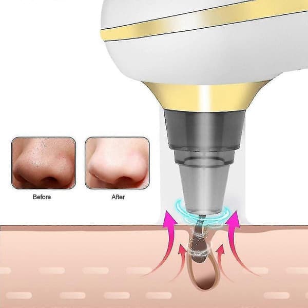 USB Blackhead Remover Ansigtsdybdevakuumsuge skønhedsrens Brug skønhedsapparater