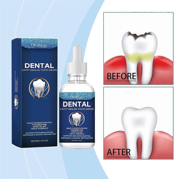 60 ml:n hammashoitoratkaisu Dentite Cavity Healing Tooth Armor