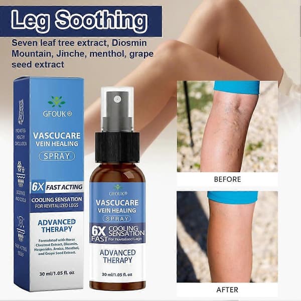 GFOUK Premium Åderbråck Massage Spray Lugnande Åderbråck Massage Spray för Bensmärta - 30ML (2ST)