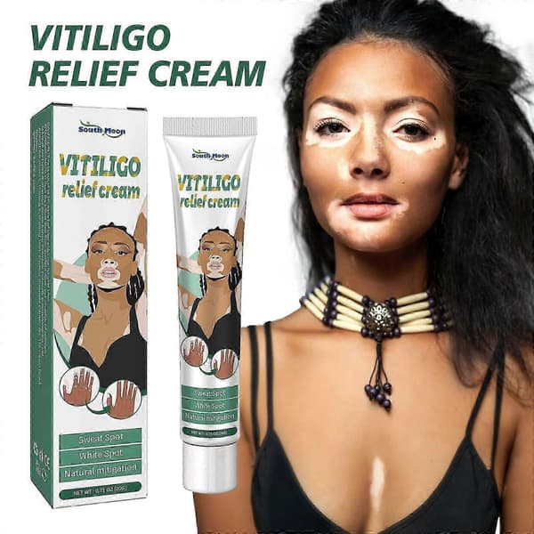 Vitiligo-voide