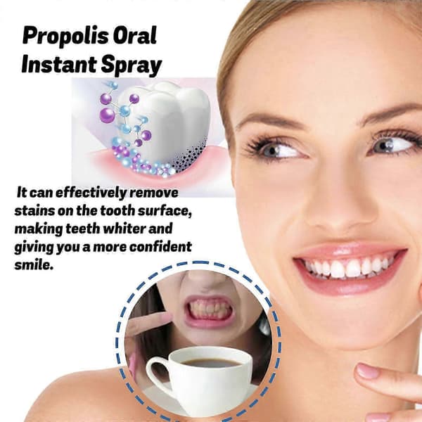 Propolis-suusuihke A
