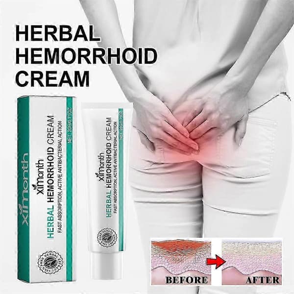 Urtehæmoridecreme til effektiv, sikker, sund, beroligende anus og fjernelse 20g (2 stk)