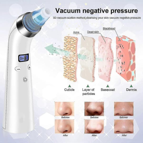 Blackhead Remover, Pore Vacuum Microdermabrasion Machine, Pore Cleaner, Blackhead Extractors with 4 Probes