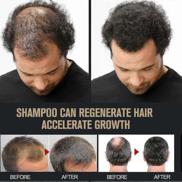 Root Activator Shampoo, Mane Root Activator Shampoo, Shampoo Root Activator främjar hårväxt för män Hårförtjockande schampo - WEI KE