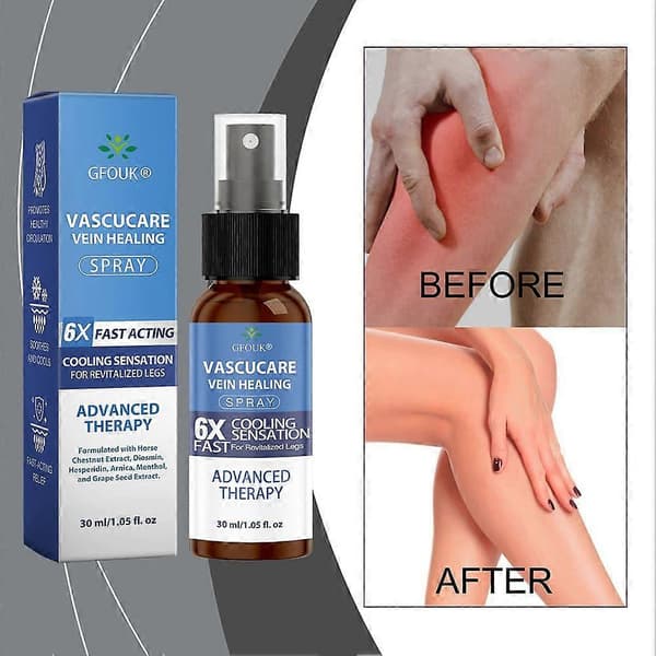 GFOUK Premium Åderbråck Massage Spray Lugnande Åderbråck Massage Spray för Bensmärta - 30ML (1PC)