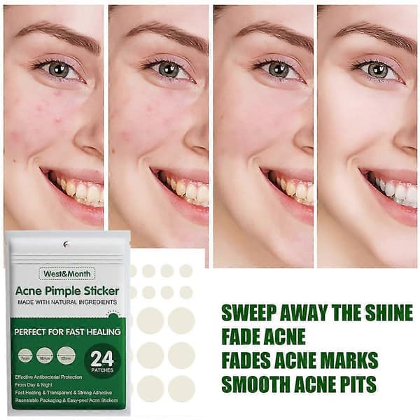 Acne Bums Sticker Usynlig Concealer Væskeabsorberende Acne