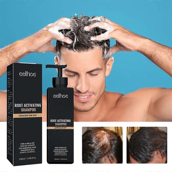 1-3 kpl Root Activator -shampoo, SPARTAN hiustenlähtöshampoo, Shampoo Root Activator (2 kpl)