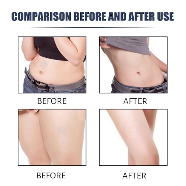 Slimmestar Perfekte Slankeplaster - Form kroppen din enkelt - 3 esker