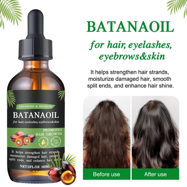 Batanaolja (60 ml) - Främjar slätt hår och hårbottenvård (Köp mer för större rabatter) 2