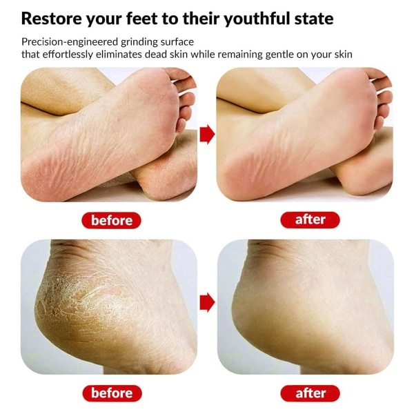 Glasfotfil för död hud, Foot Scrubber Dead Skin Remover