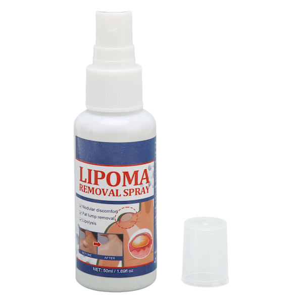 50 ml spray för borttagning av lipom, spray för borttagning av subkutana fettknölar för eliminering av fettblockering