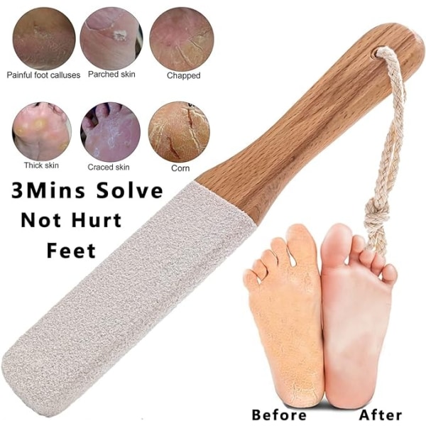 Remover Fodskrubber Fodpleje og fodeksfoliator Fodrasp Pedicureværktøj Pimpsten til fødder,fjern majs hård hud Dead Ski
