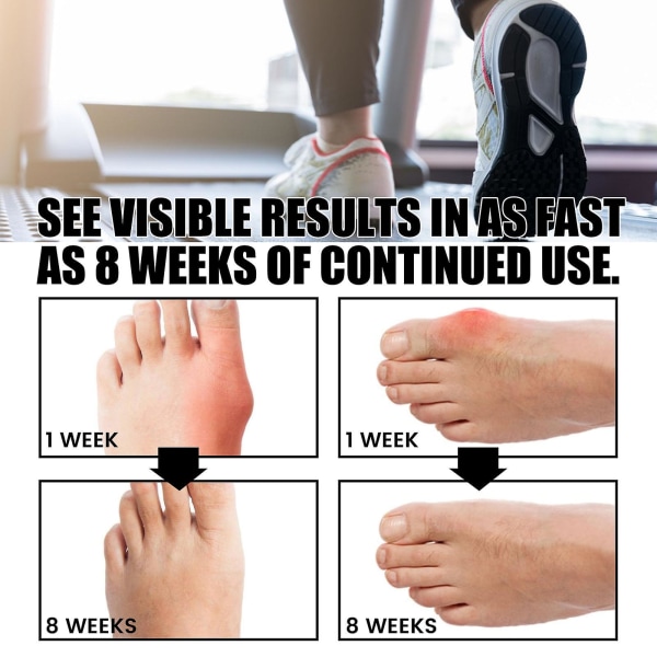 Anti Bunions Health Sock Foot Heel Care lievittää kipeä kantapää Lämpimät hengittävät jalkasukat (2 paria)