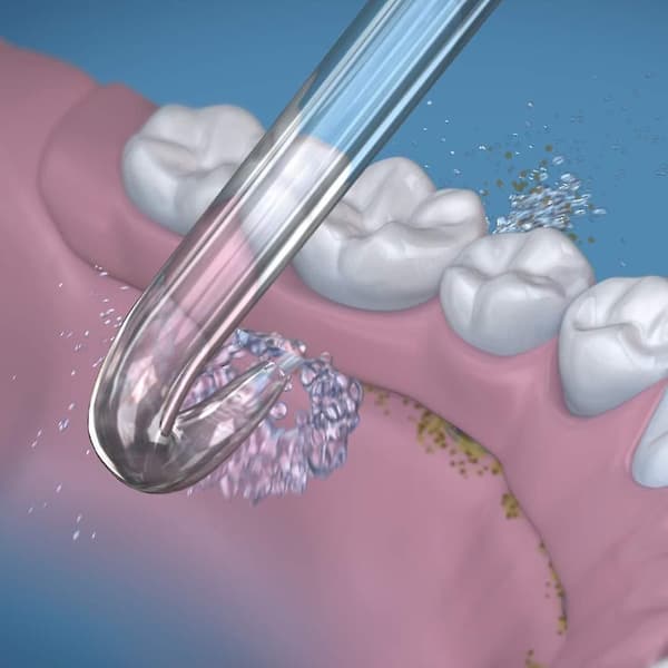Erstatningstupper for implantatproteser