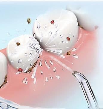 Ersättningstips för implantatproteser