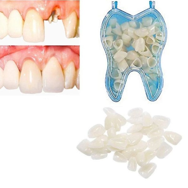 Tillfälliga protesfixeringar täcker övre proteser, fanerproteser, saknade tänder, trasiga tänder och luckor mellan tänderna