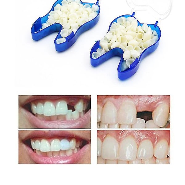 Väliaikaiset hammasproteesit tukkivat ylemmät hammasproteesit, viiluproteesit, puuttuvat hampaat, katkenneet hampaat ja hampaiden väliset raot