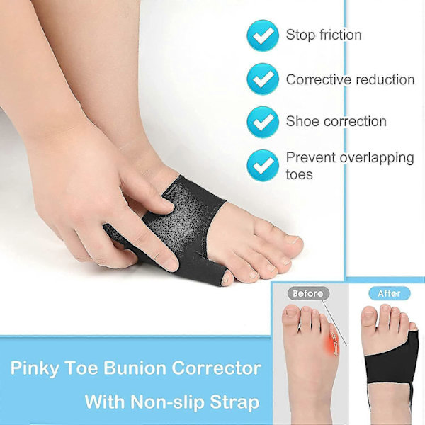 Skräddare Hallux Valgus Korrigerare 1 par Hallux Valgus Hylsor Inbyggda Gelkuddar Silikonöverdragsskydd Med Halkskyddande Rem För Att Lindra Hallux Valgus Pinky [DB]