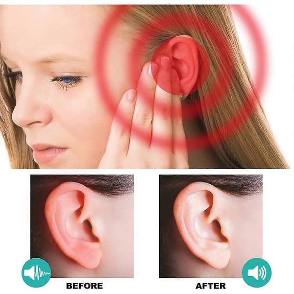 Tinnitus øredråper Behandling Kløe Øreverk Nedsatt hørsel Tinnitus Symptom 30ml 2pcs