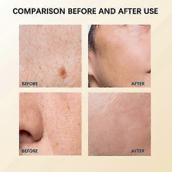 Universal Flare Care | Lindring för 97% av hudproblem | Cystor Inflammerad Hud