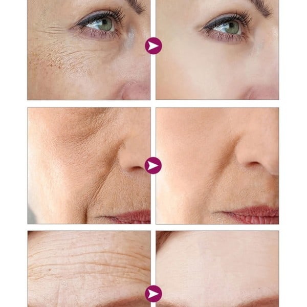 Retinol Firming Lifting Serum Wrinkle Remover Anti-aging Fade Fine Lines Ansikte Essence