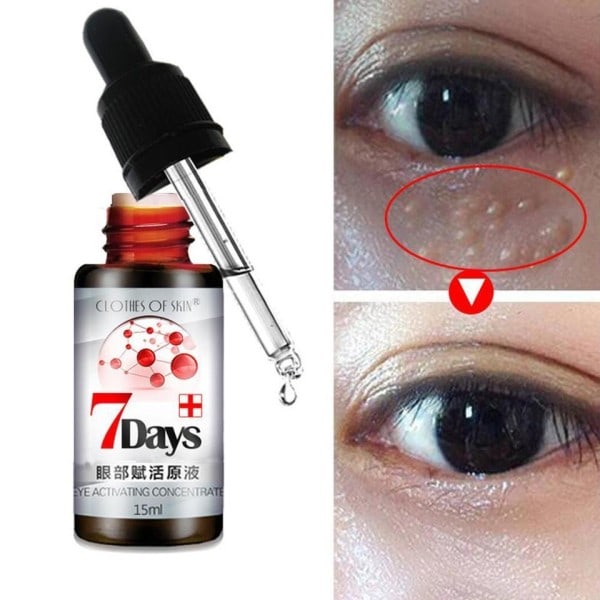 Naturligt ögon serum kräm 7 dagar ta bort mörk cirkel påsar under ögonen förhindra