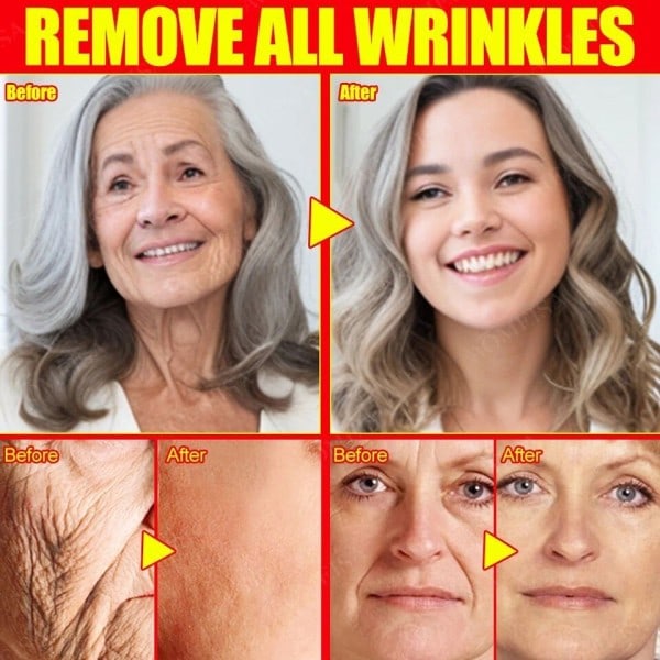 Ta bort ansiktsbehandling rynkor Anti-aging blekna fina linjer ansikte blekning ljusna hud