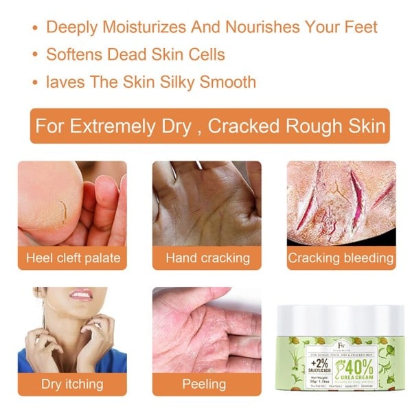 Fod Creme Hårdhud Fjerner Fod Fugtcreme Majs Hårdhud Død Skin Fjerner