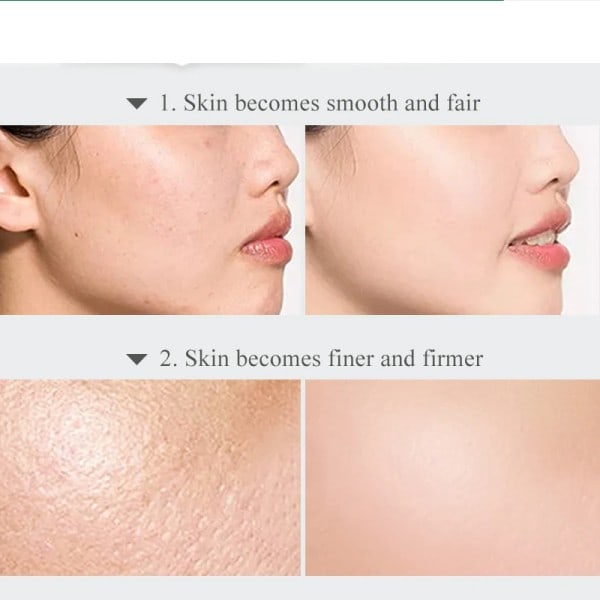 Porer Clean Blackhead Anti-aging Lighten Fine Lines Lång Laring Fuktgivande Whitening