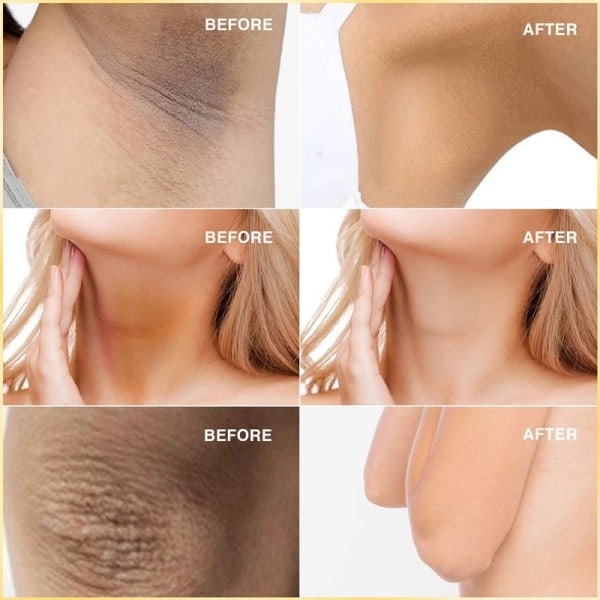 Hud Whitening Tvål Hand Tvål Lighten Mörk Underarm Ben Ta bort Död Skin Lightening  set