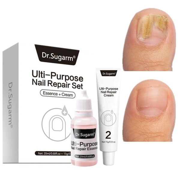 Bedste Fod Reparation Negle Set Anti Infektion