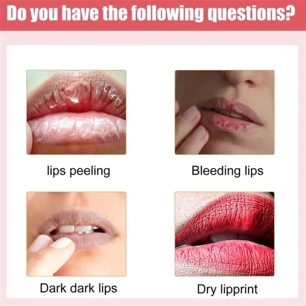 Læber Pink Cream Frisk Blegning Behandling Fjern Mørk Røg Læber Læbe balsam