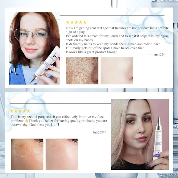 Mørk Flekk Korrektor Hud Whitening Fade Cream Lightening Blemish Fjerning