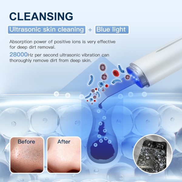Ultraljud Skin Scrubber IXP5 Vattentät Låg Noise Ljus Terapi EMS Ansiktslyft Ansiktsrengöring