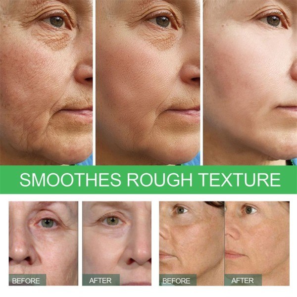 Øjeblikkelig rynke fjerner ansigt serum løftning opstrammende fade fine linjer anti aldring essens