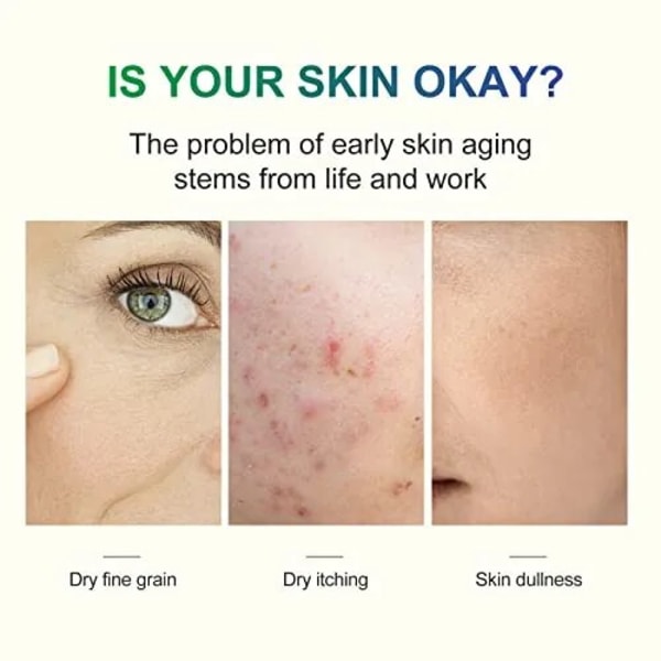 Ansigts Peel Kemisk Peel 40 Procent Peeling Serum Peeling til ansigt ansigtsbehandling eksfoliering til mørk hud