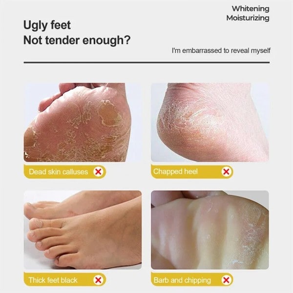 Anti-tørrende Fod creme Eksfoliering Revnet Hæl Reparation Produkt Død Skin Fjernelse creme