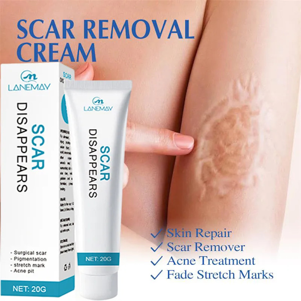 Recovery Ar Cream Hurtig Fjernelse Stræk Mærker Forbrændinger Keloider Behandling Kirurgi Ar Pigment Urte Reparation Hud Ar Glat Gel