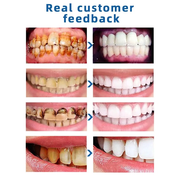 Tann Pulver Gul Blekk Oral Hygiene Tenner Hviting produkter