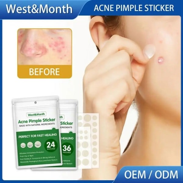 Acne Pimple Patch Osynlig Vattentät Absorbera Pus Acne Pimple Remover Verktyg Acne Cleaner