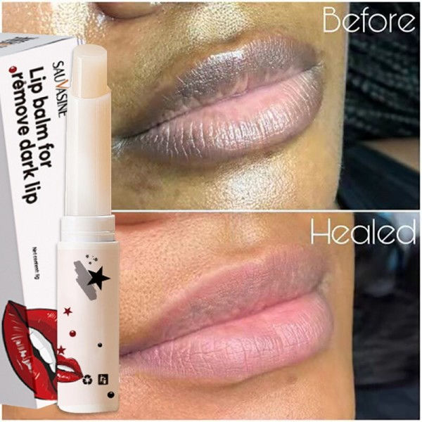 Sort Læbe Lightening Læbe Balm Fjern Kedelig Sort Læbe produkter