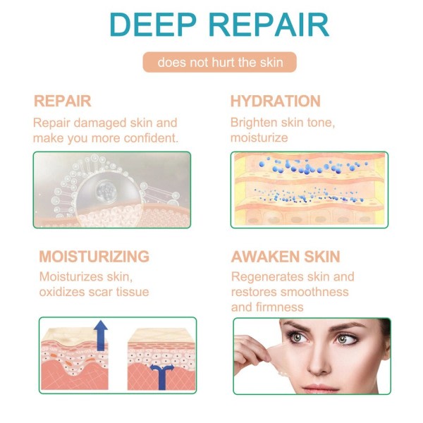 Silikone ar ark plaster smertefri ar reparation tape rulle effektiv ar fjernelse strimler