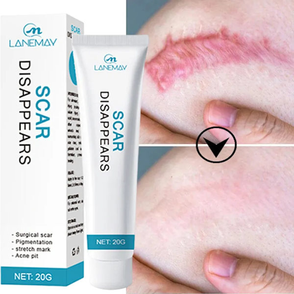 Recovery Ar Cream Hurtig Fjernelse Stræk Mærker Forbrændinger Keloider Behandling Kirurgi Ar Pigment Urte Reparation Hud Ar Glat Gel