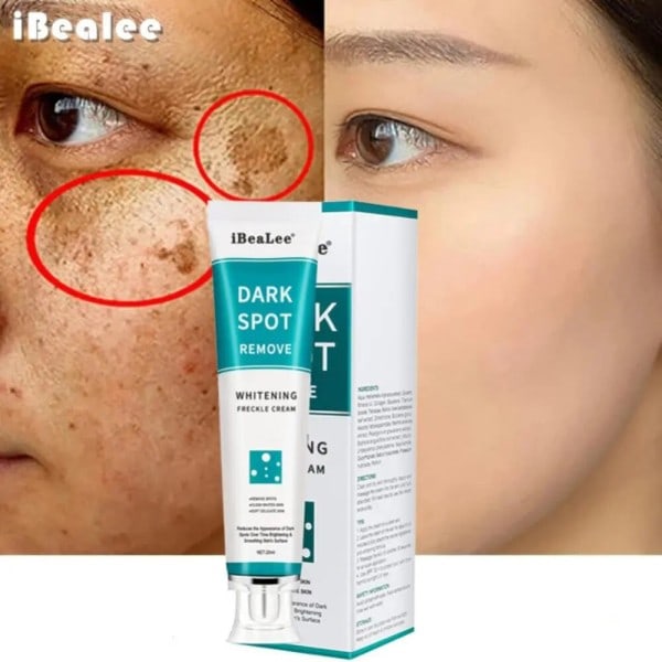 Whitening Freckle Cream Fuktgivande Ljusna upp Ansikte Ta bort Melasma Cream Ta bort Mörka Fläckar