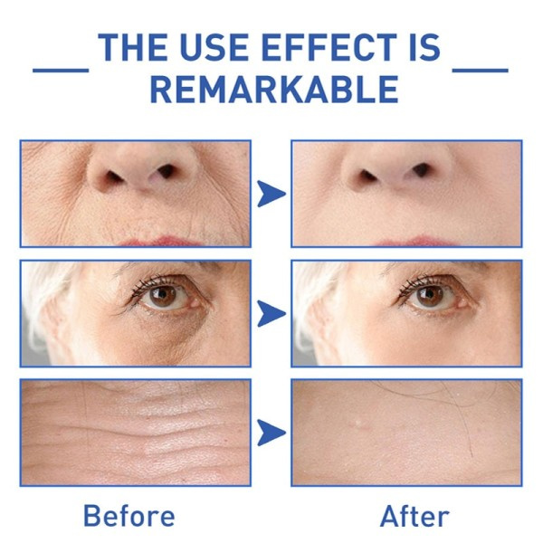Peptid Rynke Fjerner Face Serum Anti Aging Essence Lifting Opstrammende Fade Fine Lines